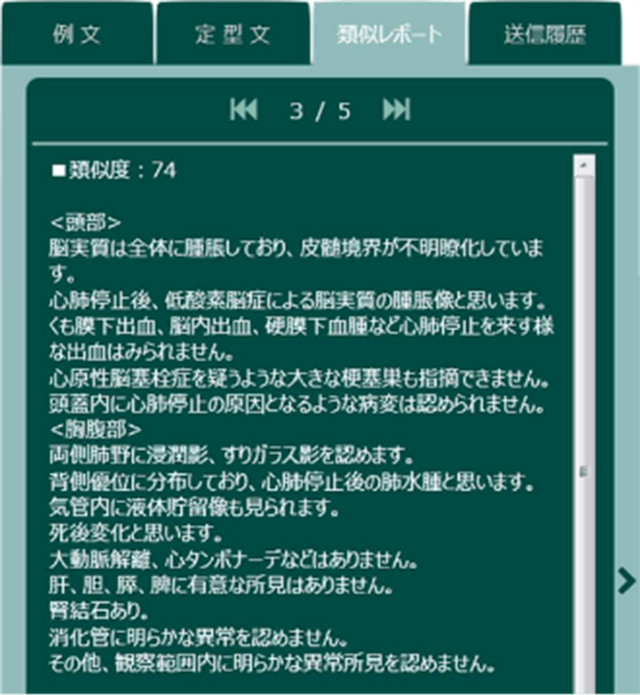 類似レポート表示機能
